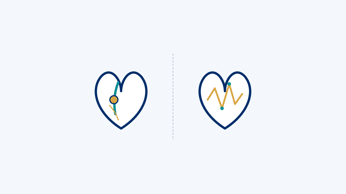Heart Attack vs Cardiac Arrest medical diagram